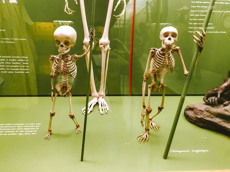 El museo alberga más de 12.000 restos humanos de todo el mundo